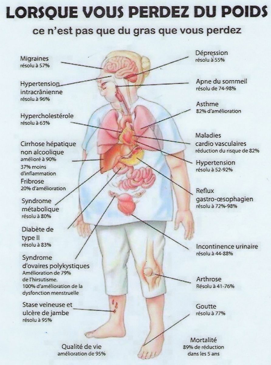 soin énergétique perte poids Grenoble